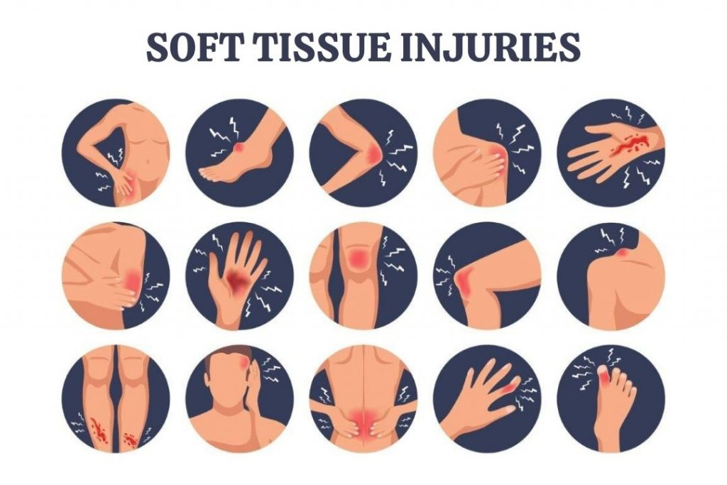 Understanding Soft Tissue Injuries