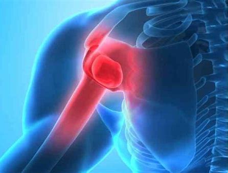 Prevention-Focused Advances in Arthroscopic LUtarjet Procedure for Adolescent Shoulder Instability